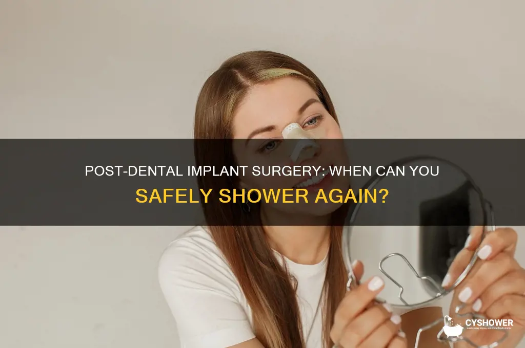 can i take a shower after dental implant surgery