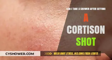 Shower After Cortisone Shot: Safe or Risky? Expert Advice