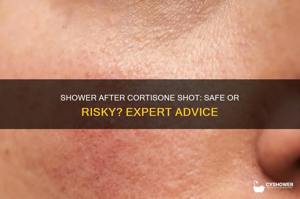 can i take a shower after getting a cortison shot