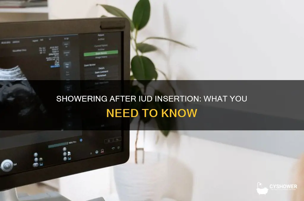 can i take a shower after getting an iud