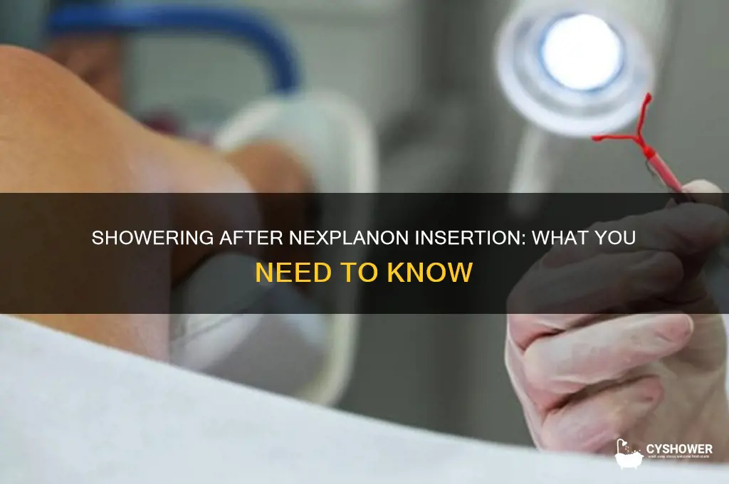 can i take a shower after getting my nexplanon