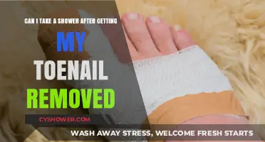 Toenail Removal Aftercare: When Can You Safely Shower Again?