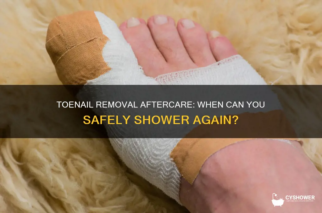 can i take a shower after getting my toenail removed
