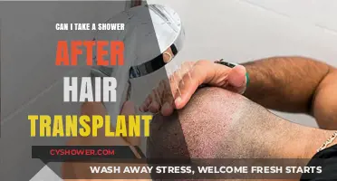 Showering After Hair Transplant: What You Need to Know