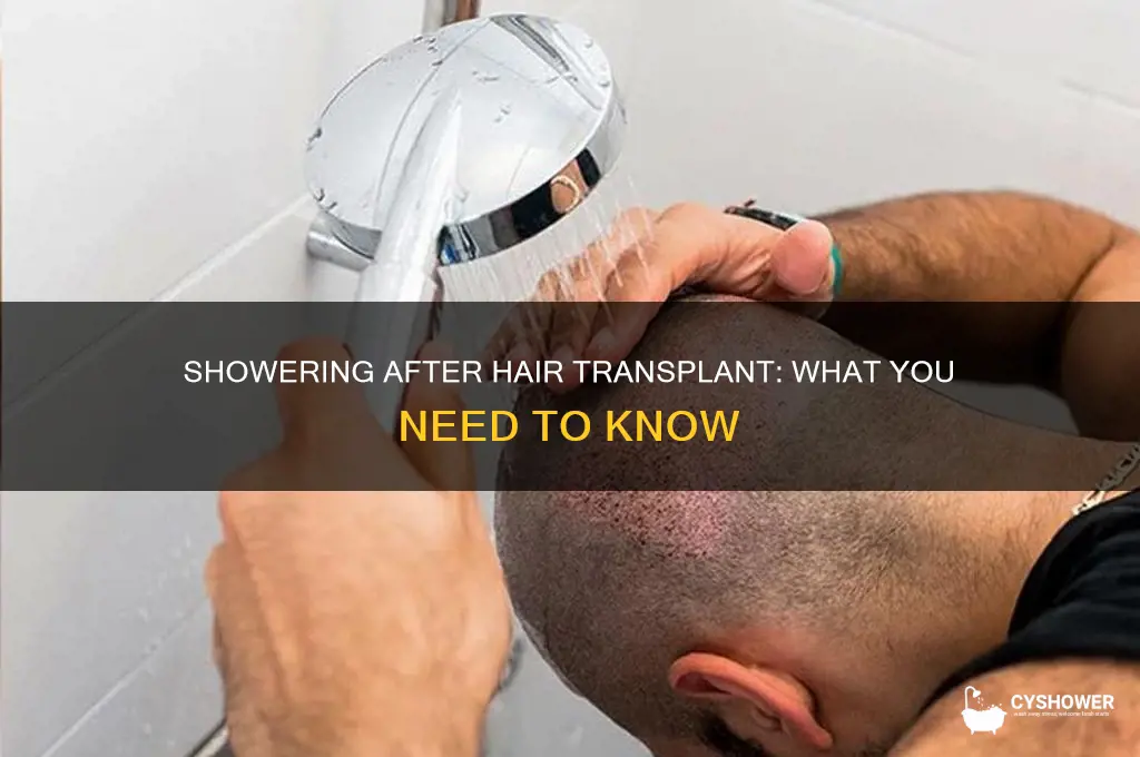 can i take a shower after hair transplant