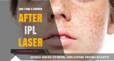 Post-IPL Laser Care: Is Showering Safe After Treatment?