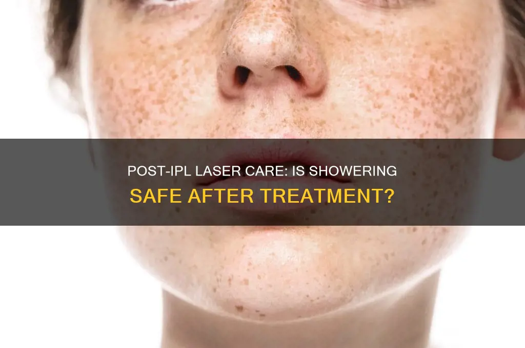 can i take a shower after ipl laser