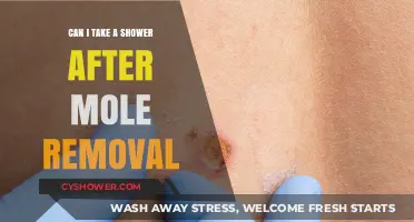 Showering After Mole Removal: Safe Practices and Healing Tips