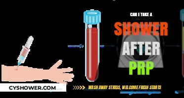 Post-PRP Shower Guidelines: When and How to Safely Cleanse