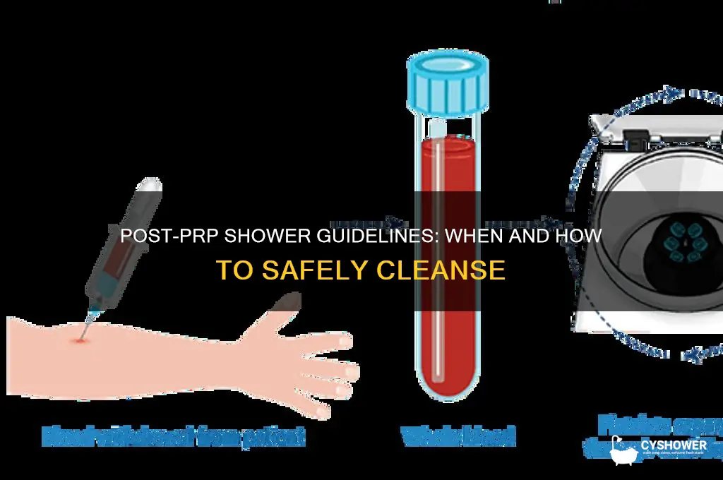 can i take a shower after prp