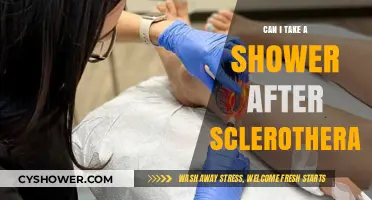 Post-Sclerotherapy Shower Guidelines: What You Need to Know