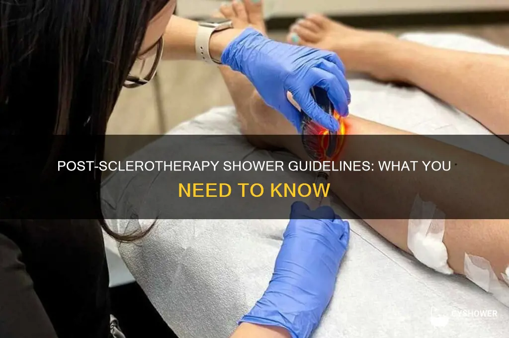 can i take a shower after sclerotherapy