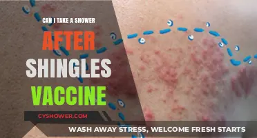 Showering After Shingles Vaccine: Safe Practices and Precautions