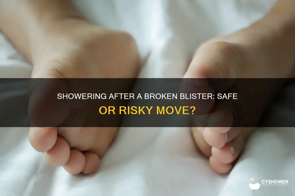 can i take a shower after the blister broke