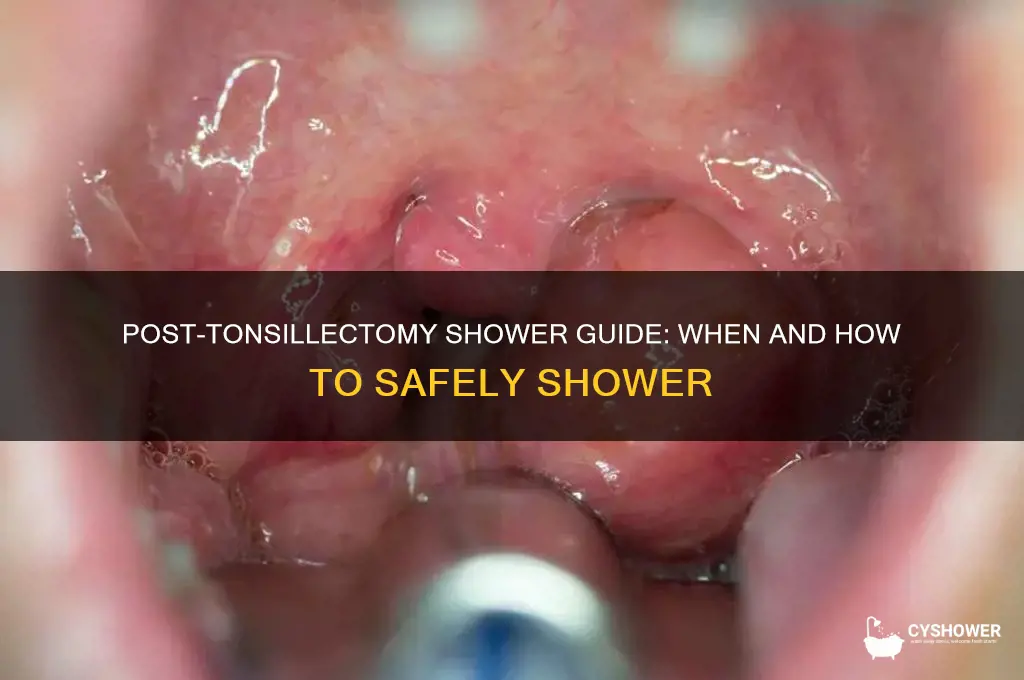 can i take a shower after tonsillectomy