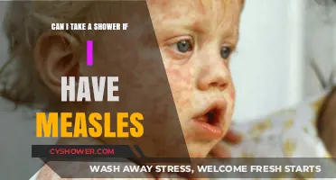Measles and Showers: Safe Practices for Bathing During Infection