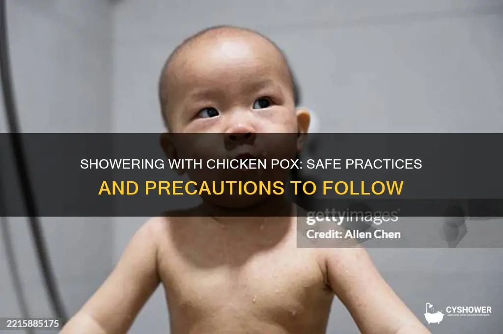 can i take a shower when i have chicken pox