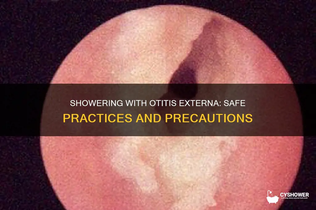 can i take a shower when i have otitis externa