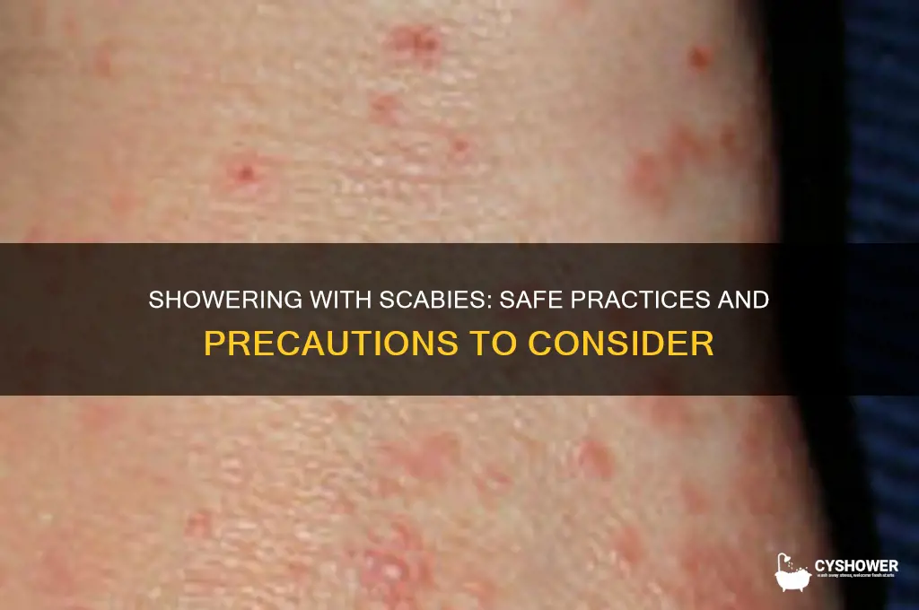 can i take a shower when i have scabies