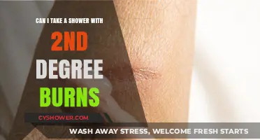 Healing Safely: Showering with Second-Degree Burns – What You Need to Know