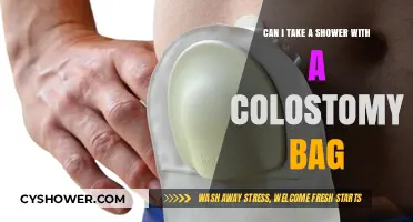 Showering with a Colostomy Bag: Tips for Comfort and Confidence