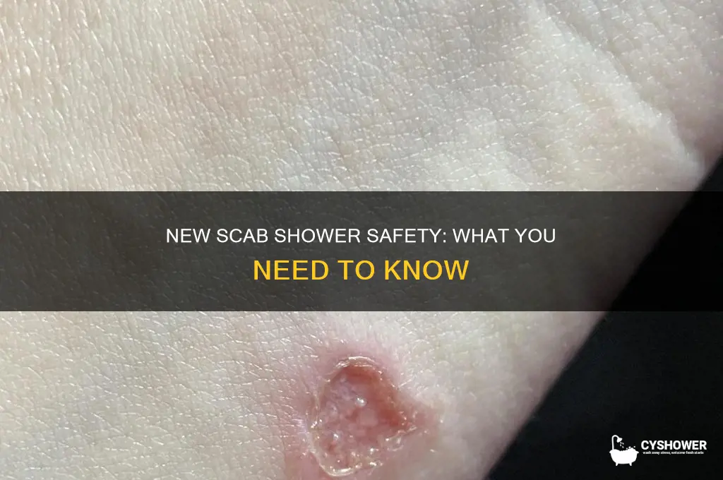can i take a shower with a new scab