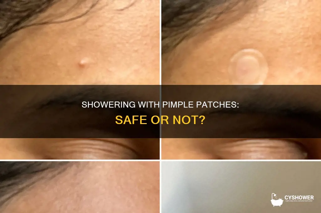 can i take a shower with a pimple patch on