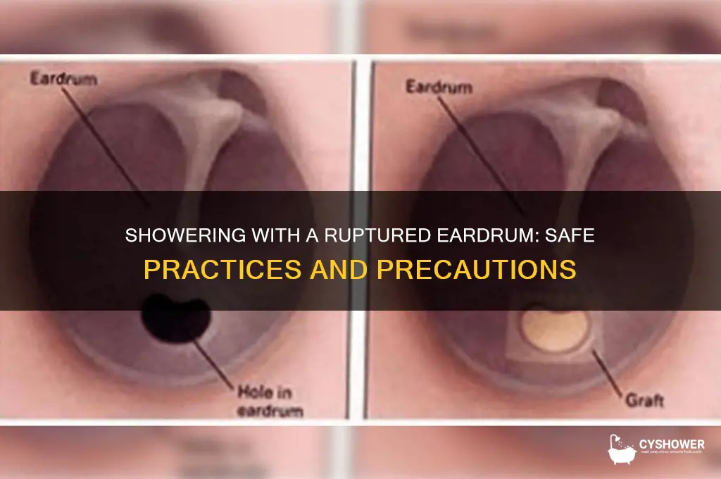 can i take a shower with a ruptured eardrum