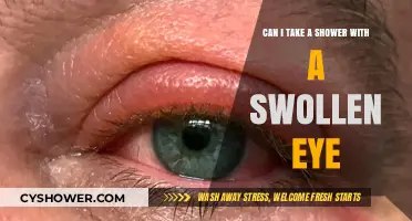 Swollen Eye Shower Guide: Safe Practices and Precautions to Follow
