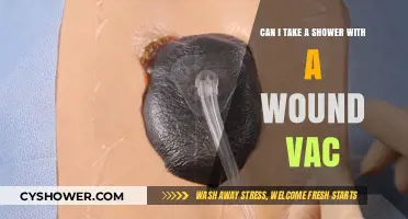Showering with a Wound Vac: Safe Practices and Precautions