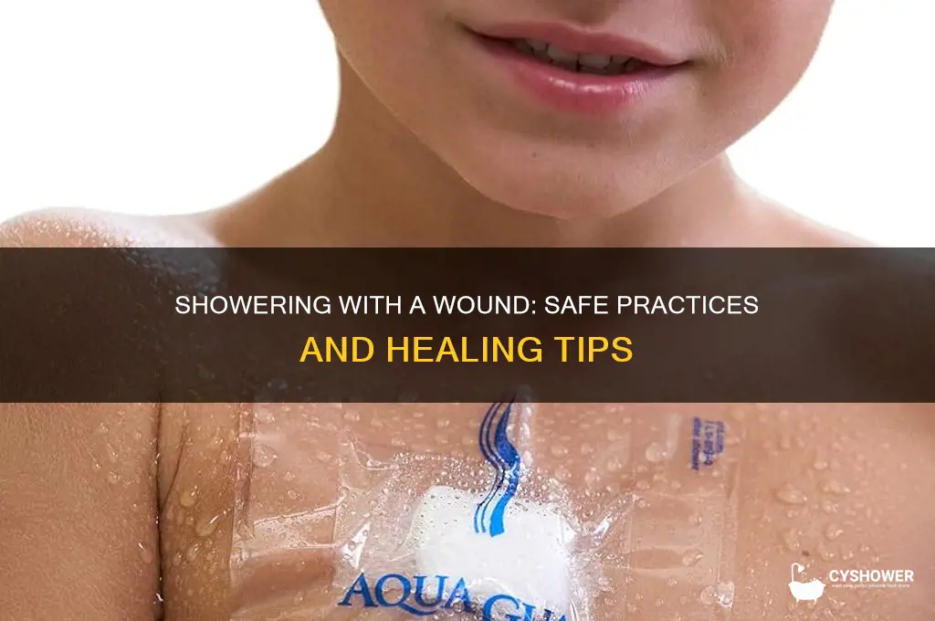 can i take a shower with a wound