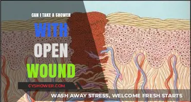 Showering with an Open Wound: Safe Practices and Precautions