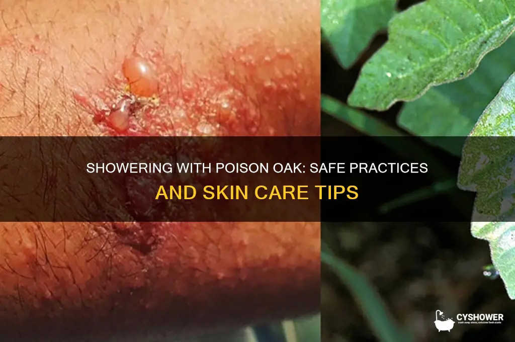 can i take a shower with poison oak