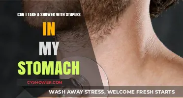 Showering with Staples: Safe Practices After Stomach Surgery Explained