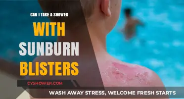 Sunburn Blisters and Showers: Safe Practices for Healing Skin