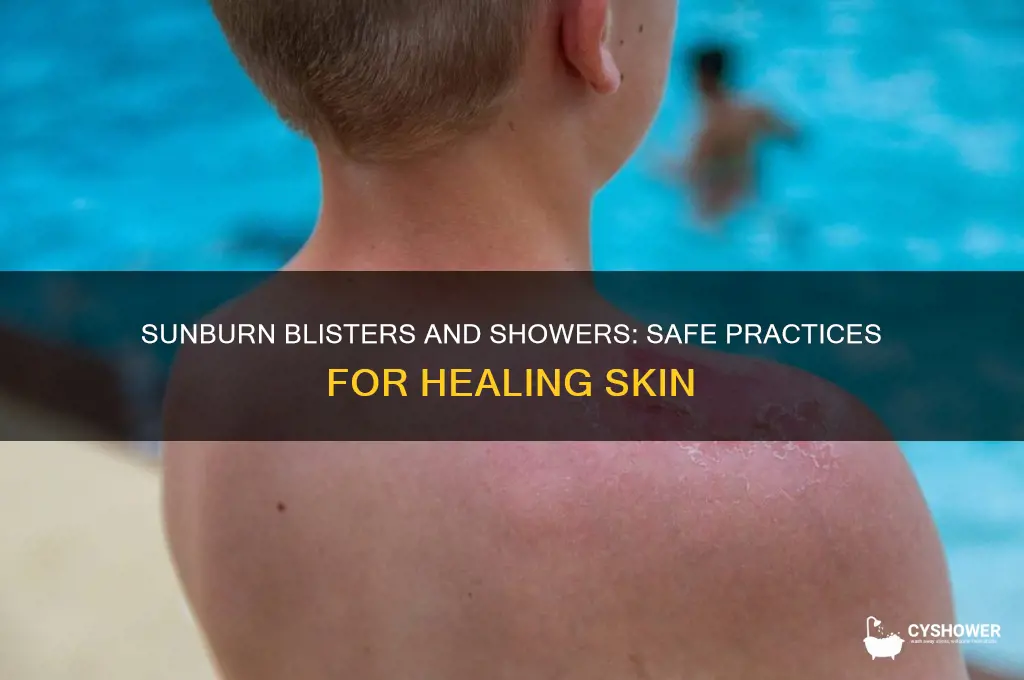 can i take a shower with sunburn blisters