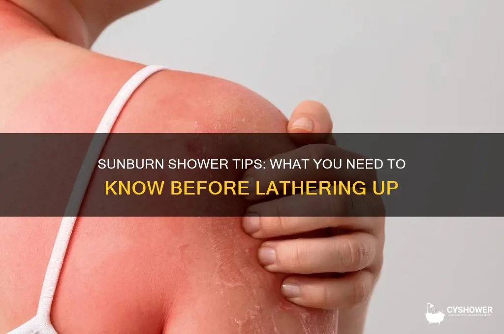 can i take a shower with sunburn