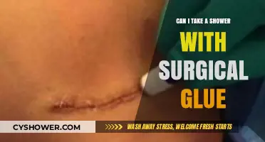 Showering with Surgical Glue: Safe Practices and Precautions