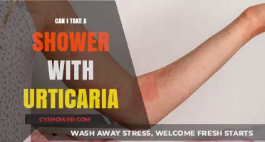 Showering with Urticaria: Safe Practices and Tips for Relief