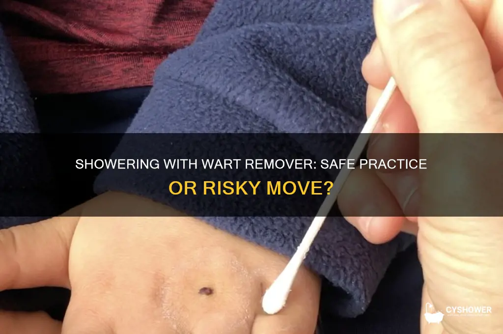 can i take a shower with wart remover