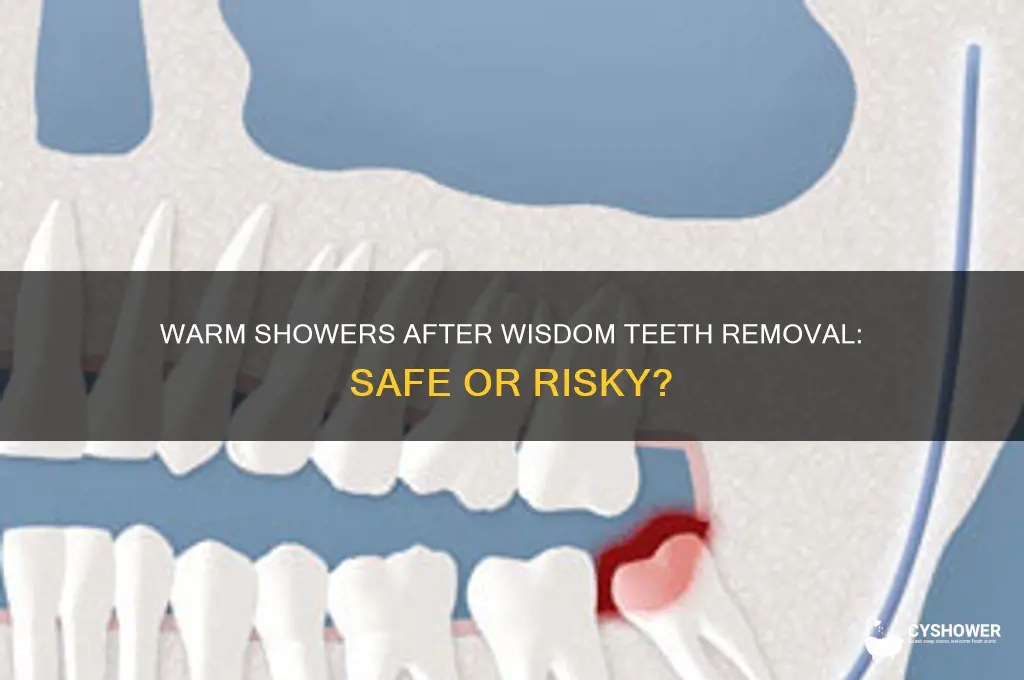 can i take a warm shower after wisdom teeth removal