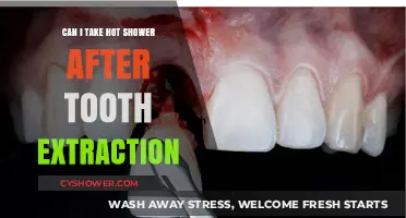 Hot Showers After Tooth Extraction: Safe or Risky Practice?