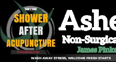 Shower After Acupuncture: Safe Practices for Post-Treatment Care