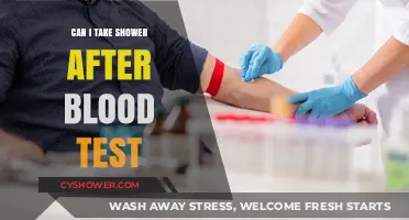 Shower After Blood Test: Safe or Should You Wait?
