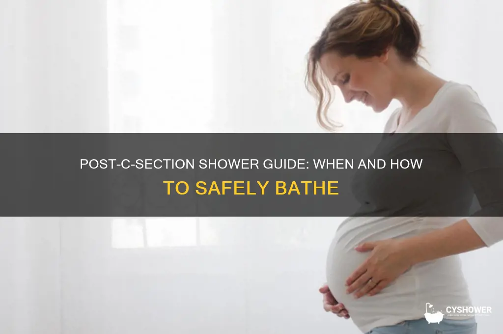 can i take shower after c section