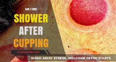 Shower After Cupping: Safe Practices and Post-Treatment Care Tips