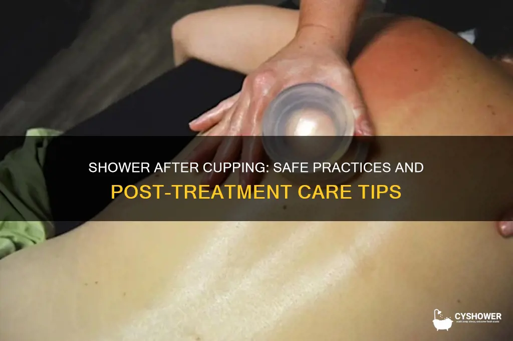 can i take shower after cupping