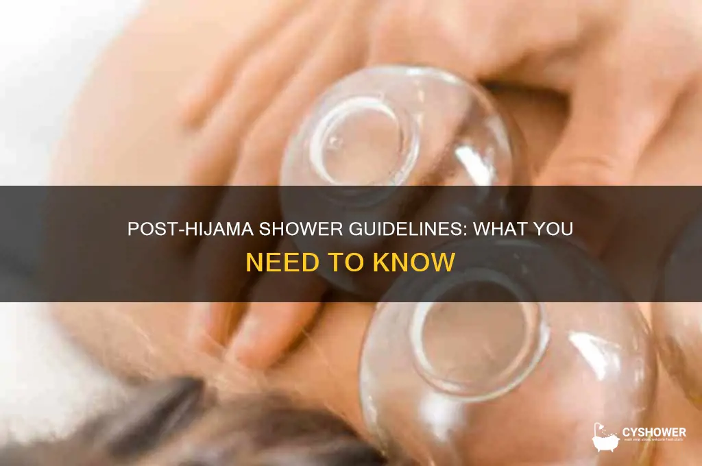 can i take shower after hijama