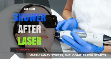 Post-Laser Shower Guide: When and How to Safely Cleanse Skin