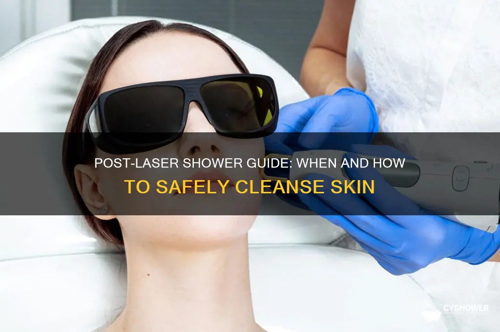 can i take shower after laser